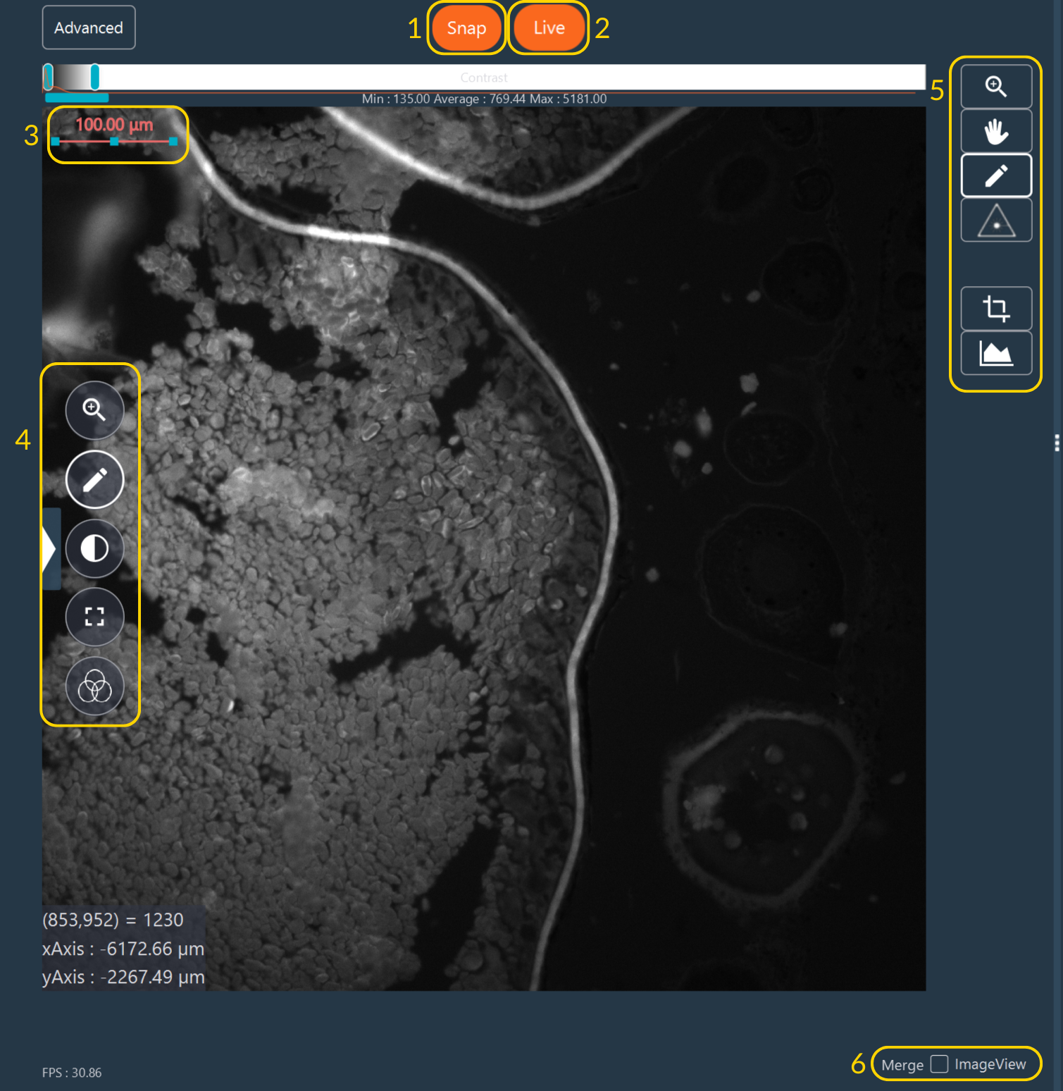 Interaction with the live images